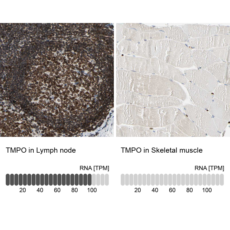 Anti-TMPO Antibody
