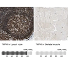 Anti-TMPO Antibody