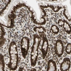 Immunohistochemical staining of human small intestine shows strong positivity in nuclear membrane in glandular cells.