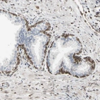 Immunohistochemical staining of human prostate shows strong positivity in nuclear membrane in glandular cells.