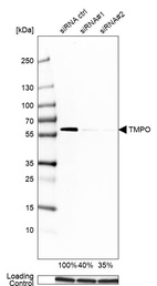 Anti-TMPO Antibody