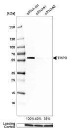 Western blot analysis in A-431 cells transfected with control siRNA, target specific siRNA probe #1 and #2, using Anti-TMPO antibody. Remaining relative intensity is presented. Loading control: Anti-GAPDH.