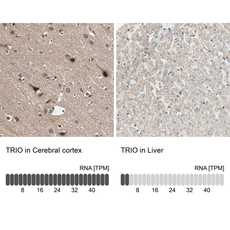 Anti-TRIO Antibody