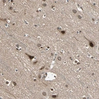 Immunohistochemical staining of human cerebral cortex shows strong cytoplasmic positivity in neurons.