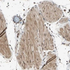 Immunohistochemical staining of human colon shows moderate cytoplasmic positivity in smooth muscle cells.