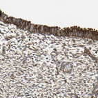 Immunohistochemical staining of human endometrium shows strong cytoplasmic positivity in glandular cells.