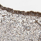 Immunohistochemical staining of human endometrium shows strong cytoplasmic positivity in glandular cells.