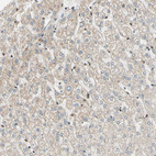 Immunohistochemical staining of human liver shows no positivity in hepatocytes.