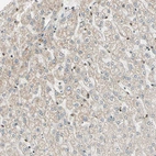 Immunohistochemical staining of human liver shows no positivity in hepatocytes.