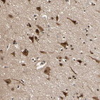 Anti-NGEF Antibody