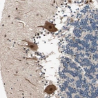 Immunohistochemical staining of human Cerebellum shows strong cytoplasmic and nuclear positivity in Purkinje cells.