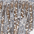 Immunohistochemical staining of human Duodenum shows moderate cytoplasmic and membranous positivity in glandular cells.