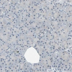 Immunohistochemical staining of human Pancreas shows no cytoplasmic positivity in exocrine glandular cells as expected.