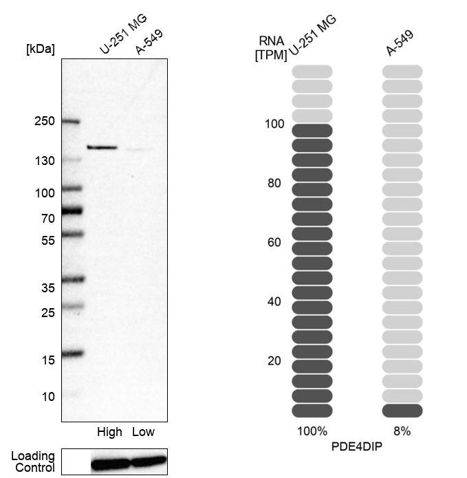 Anti-PDE4DIP Antibody