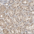 Immunohistochemical staining of human kidney shows moderate cytoplasmic positivity in cells in tubules.