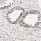 Immunohistochemical staining of human prostate shows moderate cytoplasmic positivity in glandular cells.