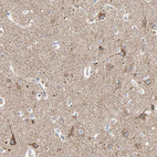 Immunohistochemical staining of human cerebral cortex shows moderate cytoplasmic positivity in neurons.