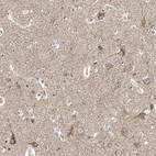 Immunohistochemical staining of human cerebral cortex shows moderate cytoplasmic positivity in neurons.