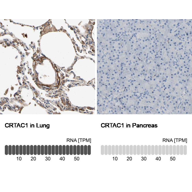 Anti-CRTAC1 Antibody