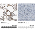 Anti-CRTAC1 Antibody