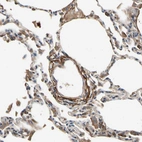Immunohistochemical staining of human lung shows strong positivity in extracellular matrix.