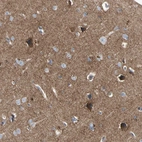 Immunohistochemical staining of human cerebral cortex shows strong cytoplasmic positivity in a subset of neurons.