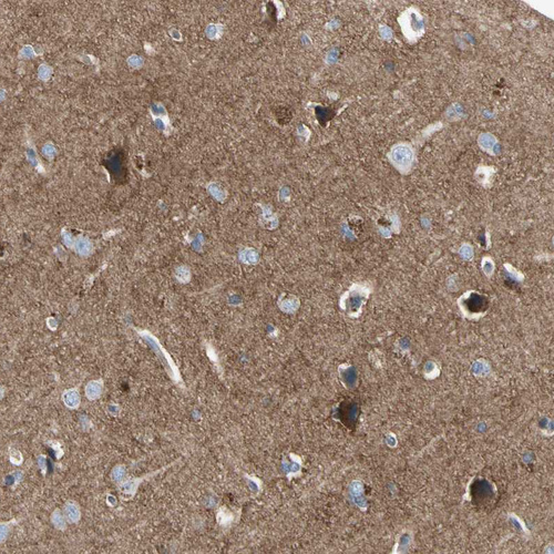 Anti-CRTAC1 Antibody