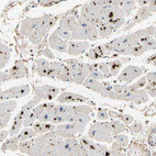 Immunohistochemical staining of human heart muscle shows strong cytoplasmic positivity with a dot like pattern in cardiomyocytes.
