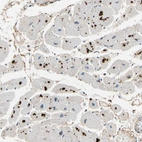 Immunohistochemical staining of human heart muscle shows strong cytoplasmic positivity with a dot like pattern in cardiomyocytes.
