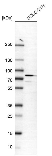 Anti-CRTAC1 Antibody