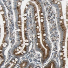 Immunohistochemical staining of human small intestine shows strong positivity in Golgi apparatus in glandular cells.