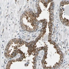 Immunohistochemical staining of human prostate shows strong granular cytoplasmic positivity in glandular cells.