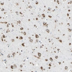 Immunohistochemical staining of human cerebral cortex shows moderate granular cytoplasmic positivity in neurons.