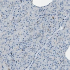 Immunohistochemical staining of human pancreas shows no positivity in exocrine glandular cells as expected.