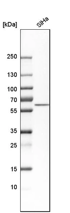 Western blot analysis in human cell line SiHa.
