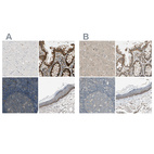 Anti-MST1R Antibody