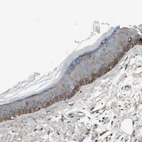 Immunohistochemical staining of human skin shows moderate cytoplasmic and membranous positivity in squamous epithelial cells.