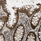 Anti-MST1R Antibody