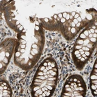 Immunohistochemical staining of human rectum shows moderate cytoplasmic and membranous positivity in glandular cells.