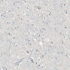Immunohistochemical staining of human cerebral cortex shows no positivity in neurons as expected.