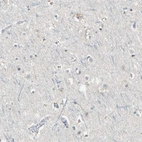 Immunohistochemical staining of human cerebral cortex shows no positivity in neurons as expected.