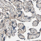 Anti-LIMK2 Antibody