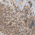 Immunohistochemical staining of human placenta shows moderate cytoplasmic positivity in decidual cells.