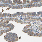 Immunohistochemical staining of human fallopian tube shows moderate cytoplasmic positivity in glandular cells.