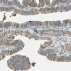 Immunohistochemical staining of human fallopian tube shows moderate cytoplasmic positivity in glandular cells.