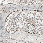 Immunohistochemical staining of human testis shows strong cytoplasmic positivity in cells in seminiferous ducts.