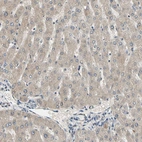 Immunohistochemical staining of human liver shows weak cytoplasmic positivity in hepatocytes.