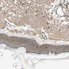 Immunohistochemical staining of human skin shows moderate cytoplasmic positivity in squamous epithelial cells.