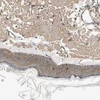 Immunohistochemical staining of human skin shows moderate cytoplasmic positivity in squamous epithelial cells.