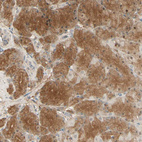 Immunohistochemical staining of human stomach shows moderate cytoplasmic positivity in glandular cells.